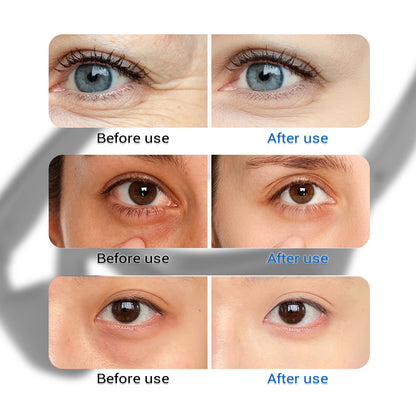 Microcurrent Massage Eye Care Device