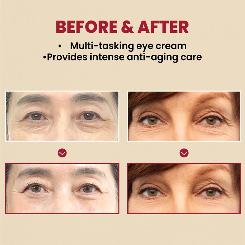Retinol Eye Cream