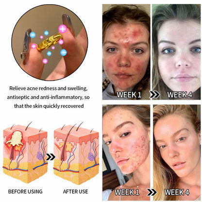 （🔥LAST DAY SALE-60% OFF) 💖Lymphatic magnetic therapy cats eye ring