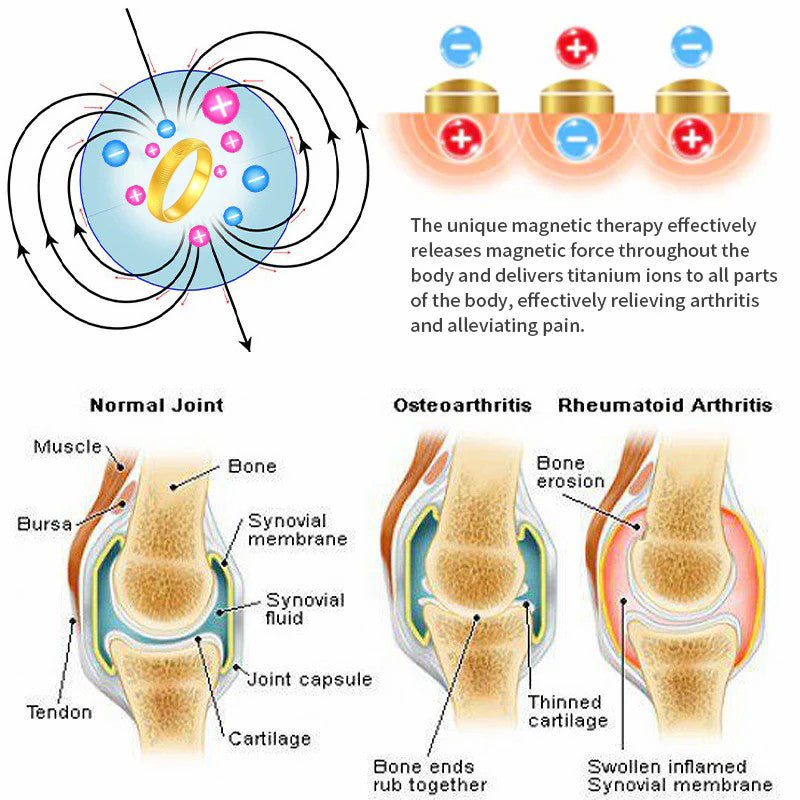 （🔥LAST DAY SALE-60% OFF) 💖Lymphatic magnetic therapy cats eye ring