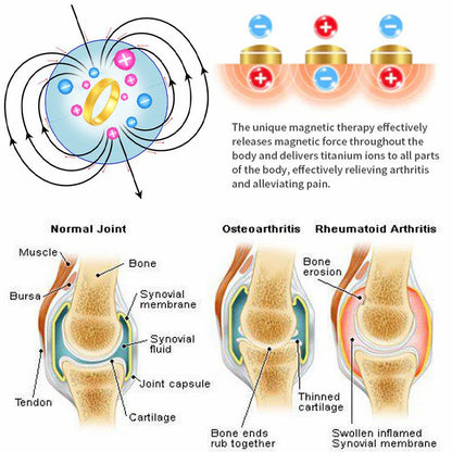 （🔥LAST DAY SALE-60% OFF) 💖Lymphatic magnetic therapy cats eye ring