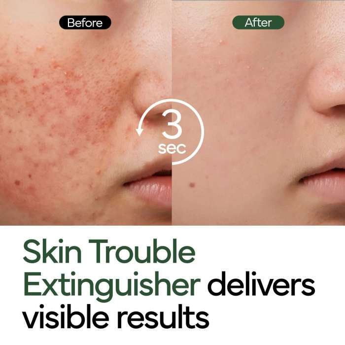 Intensive Cica Repair Cream